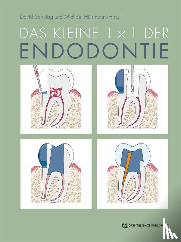  - Das kleine 1x1 der Endodontie