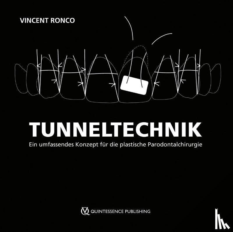 Ronco, Vincent - Tunneltechnik
