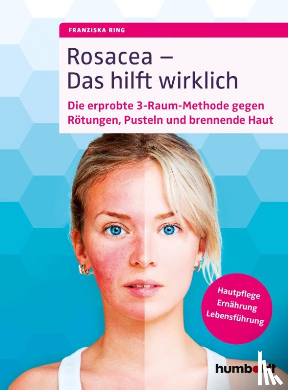 Ring, Franziska - Rosacea - Das hilft wirklich