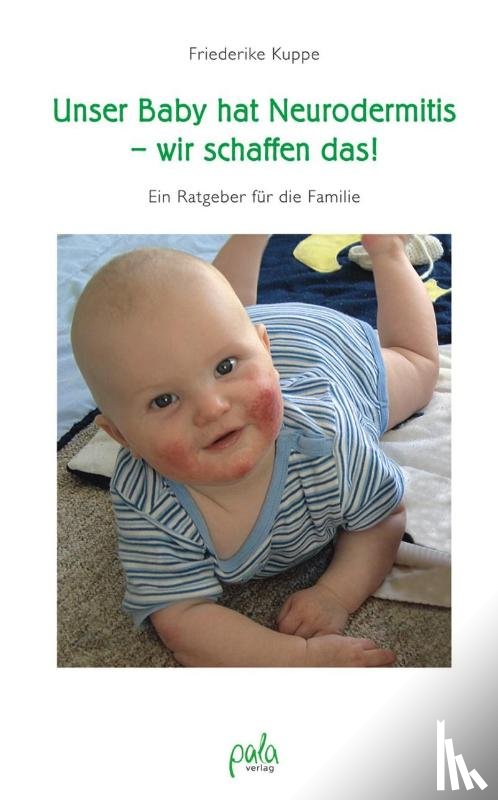 Kuppe, Friederike - Unser Baby hat Neurodermitis - wir schaffen das!