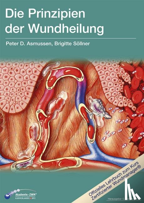 Asmussen, Peter D., Söllner, Brigitte - Die Prinzipien der Wundheilung