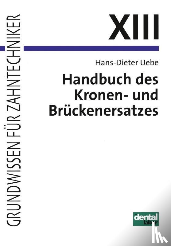 Uebe, Hans-Dieter - Handbuch des Kronen- und Brückenersatzes