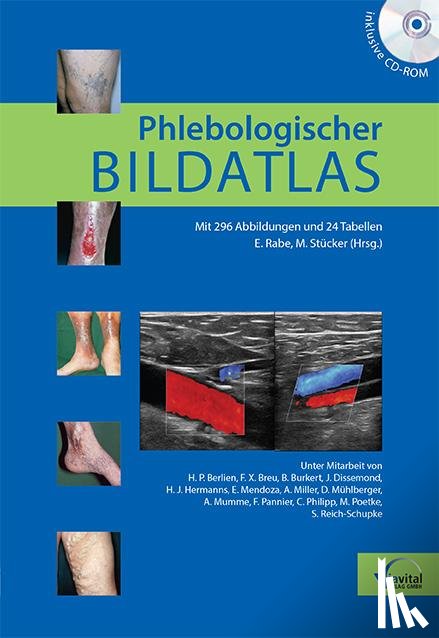  - Phlebologischer Bildatlas