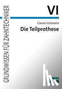Caesar, Hans H., Lehmann, Klaus M. - Die Teilprothese