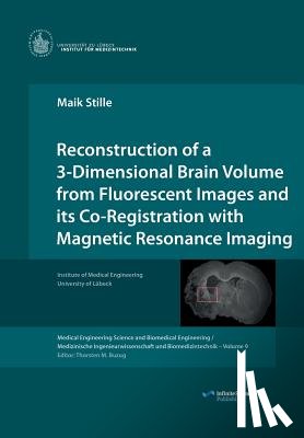 Stille, Maik - Reconstruction of a 3-Dimensional Brain Volume from Fluorescent Images and its Co-Registration with Magnetic Resonance Imaging