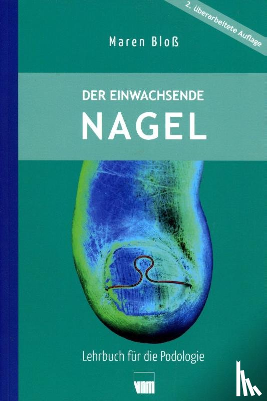 Bloß, Maren - Der eingewachsenen Nagel