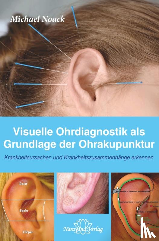 Noack, Michael - Visuelle Ohrdiagnostik als Grundlage der Ohrakupunktur