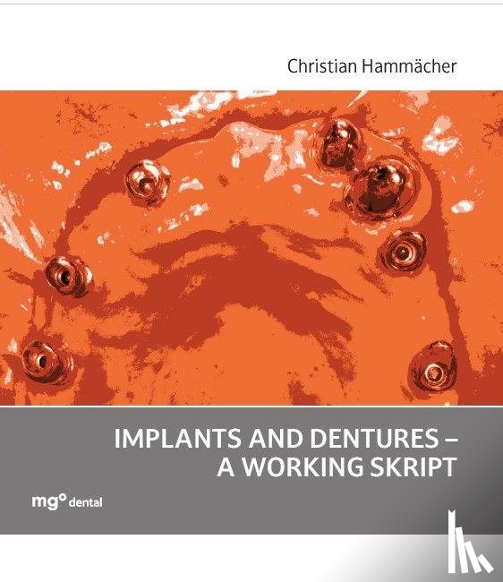 Hammächer, Christian - Implants and dentures - a working skript