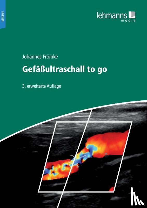 Frömke, Johannes - Gefäßultraschall to go