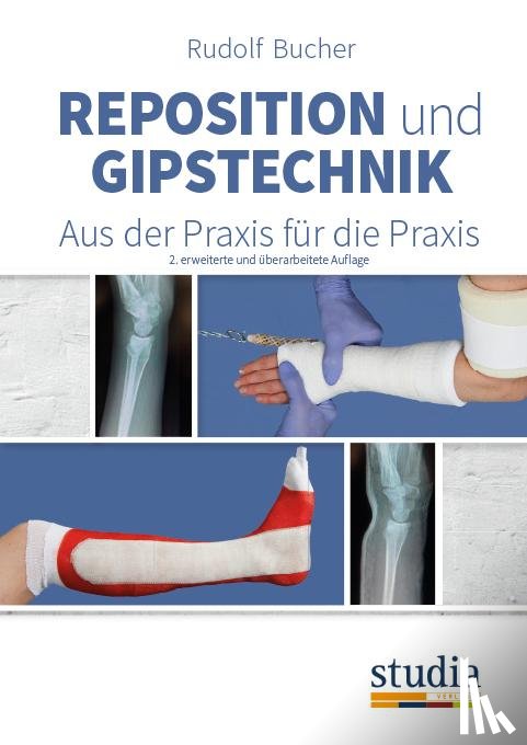 Bucher, Rudolf - Reposition und Gipstechnik II