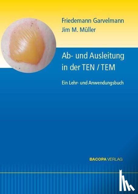 Garvelmann, Friedemann, Müller, Jim M. - Ab- und Ausleitungsverfahren in der TEN/TEM.