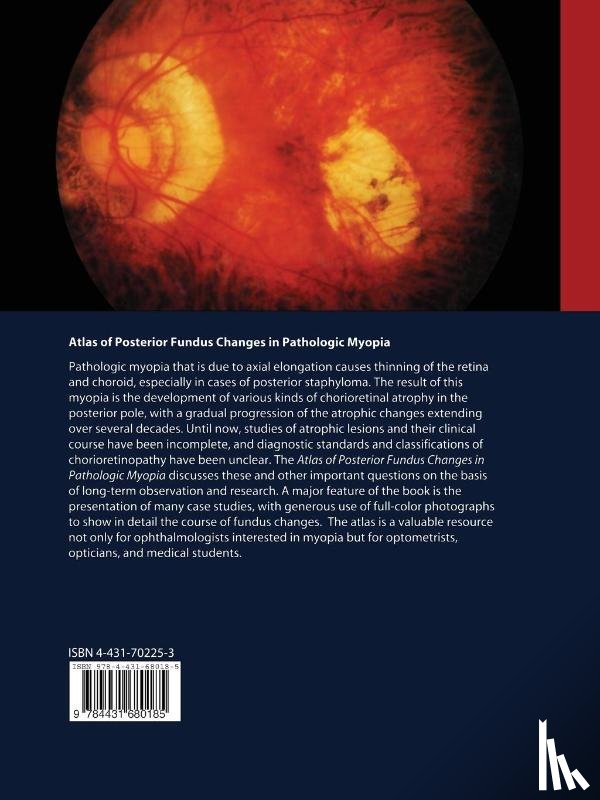 Tokoro, Takashi - Atlas of Posterior Fundus Changes in Pathologic Myopia
