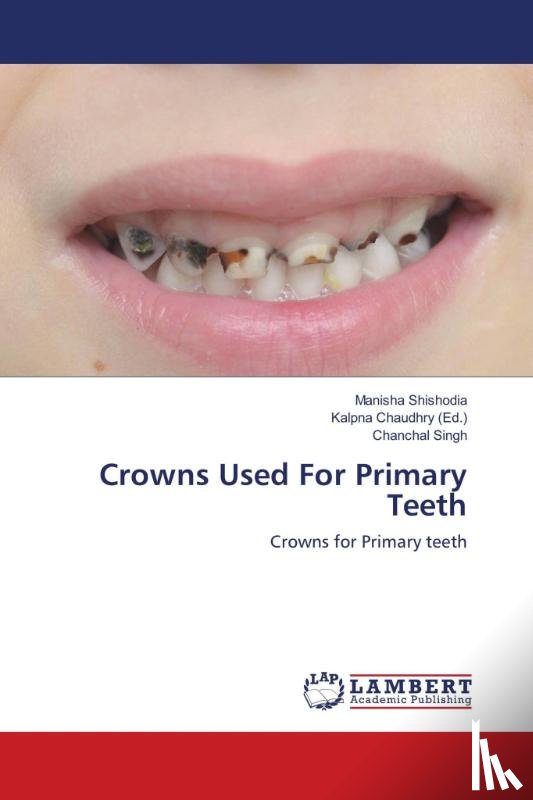 Shishodia, Manisha, Singh, Chanchal - Crowns Used For Primary Teeth