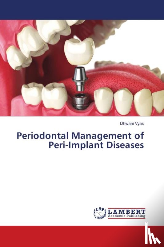 Vyas, Dhwani - Periodontal Management of Peri-Implant Diseases