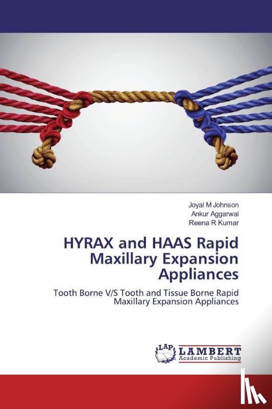 M Johnson, Joyal, Aggarwal, Ankur, Kumar, Reena R - HYRAX and HAAS Rapid Maxillary Expansion Appliances