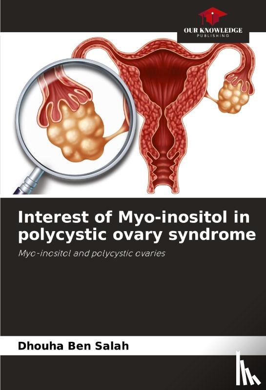 Ben Salah, Dhouha - Interest of Myo-inositol in polycystic ovary syndrome