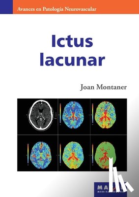 Montaner, Joan - Ictus lacunar