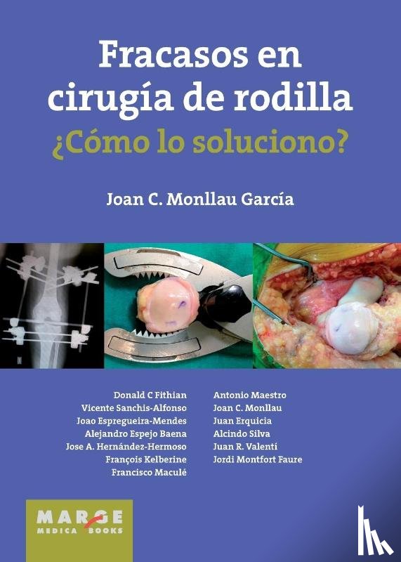 Monllau García, Juan C. - Fracasos en cirugía de rodilla ¿Cómo lo soluciono?