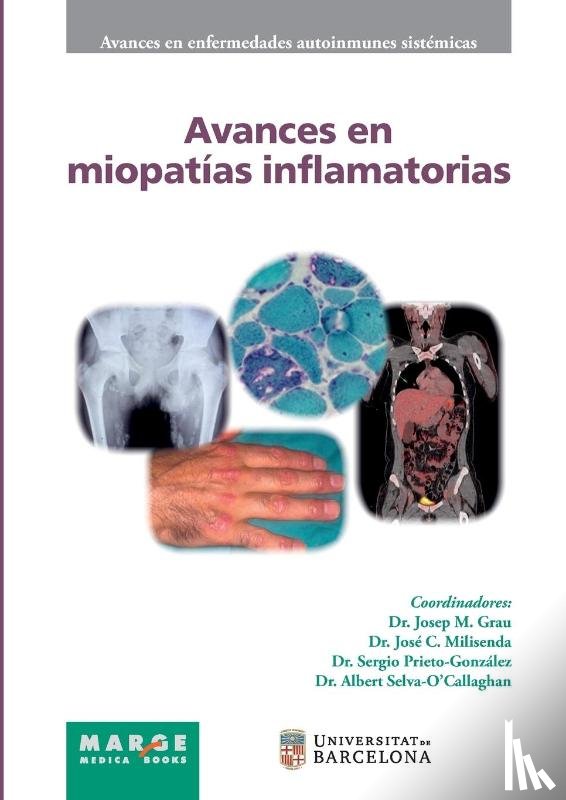 Cervera, Ricard, Grau, Josep M., Milisenda, José C. - Avances en miopatías inflamatorias