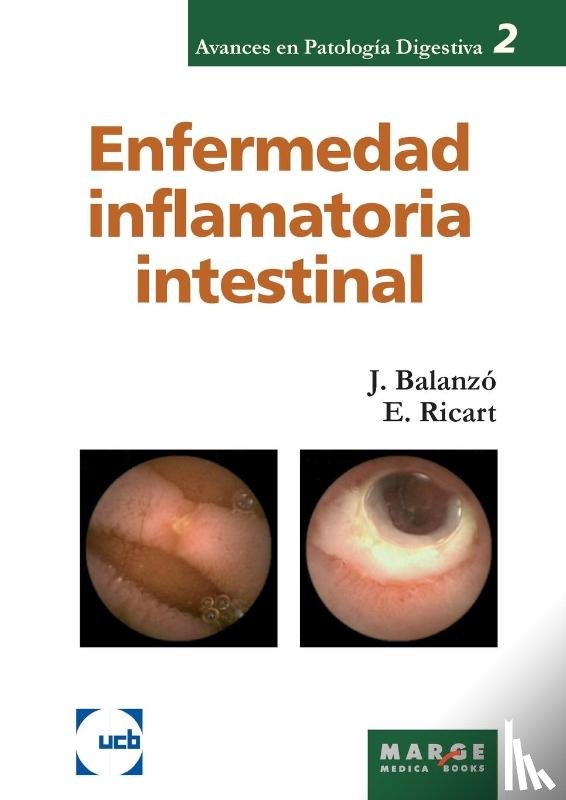 Ricart Gómez, Elena, Balanzó Tintoré, Joaquim - Enfermedad inflamatoria intestinal