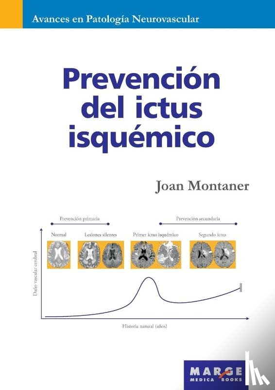Montaner, Joan - Prevención del ictus isquémico