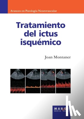 Montaner, Joan - Tratamiento del ictus isquémico