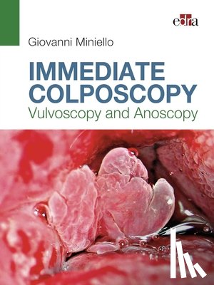 Miniello, Giovanni - Immediate Colposcopy - Vulvoscopy and Anoscopy
