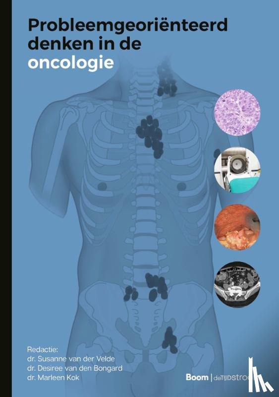  - Probleemgeoriënteerd denken in de oncologie