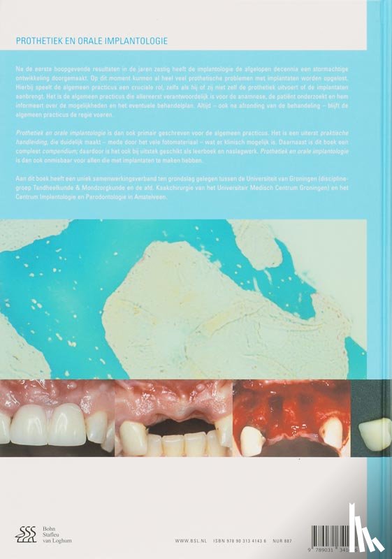 Meijer, H., Lange, G. de - Prothetiek en orale implantologie