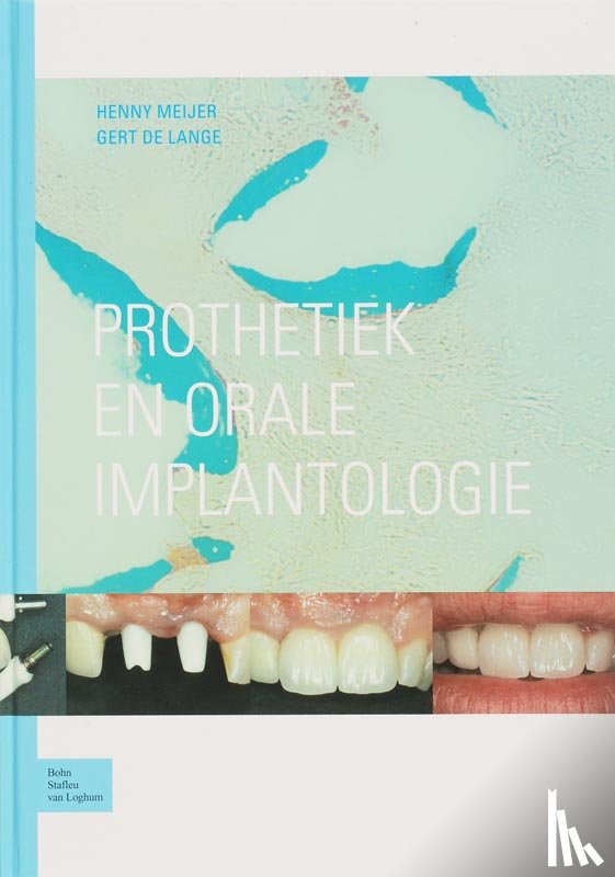 Meijer, H., Lange, G. de - Prothetiek en orale implantologie