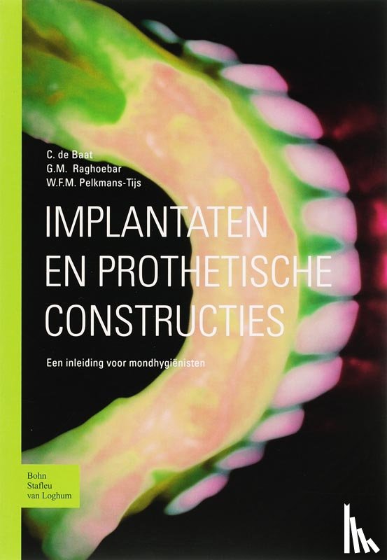 Baat, C. de, Raghoebar, J., Pelkmans-Tijs, W.F.M. - Implantaten en prothetische constructies