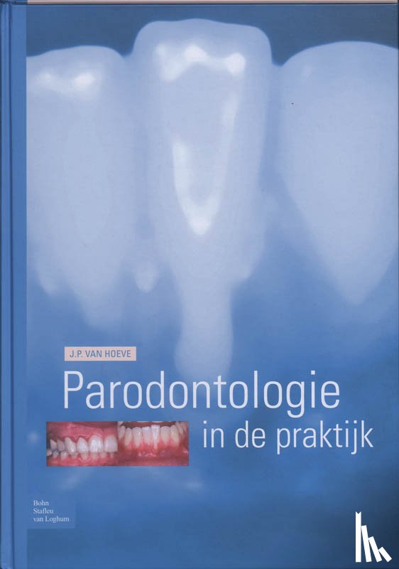 Hoeve, J.P. van - Parodontologie in de Praktijk
