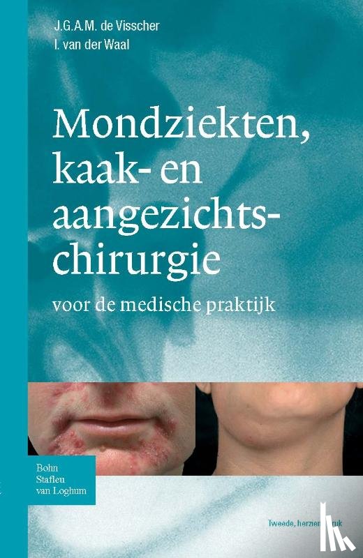 Visscher, J.G.A.M. de, Waal, I. van de - Zakboek mondziekten, kaak- en aangezichtchirurgie