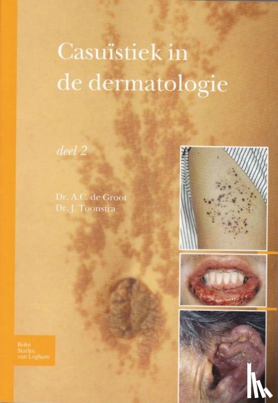 Toonstra, Johan, Groot, A.C. - Casuïstiek in de dermatologie