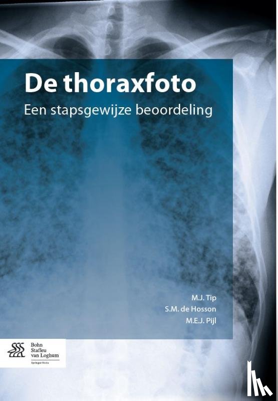  - De thoraxfoto