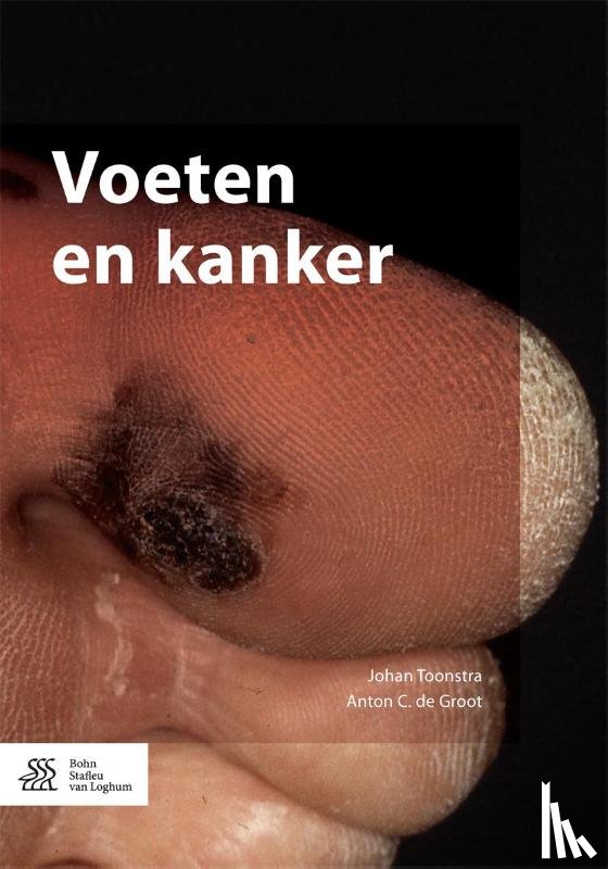 Toonstra, Johan, Groot, Anton C. de - Voeten en kanker