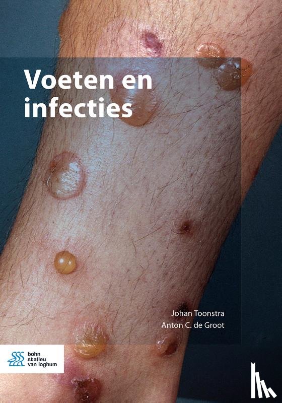 Toonstra, Johan, de Groot, Anton - Voeten en infecties