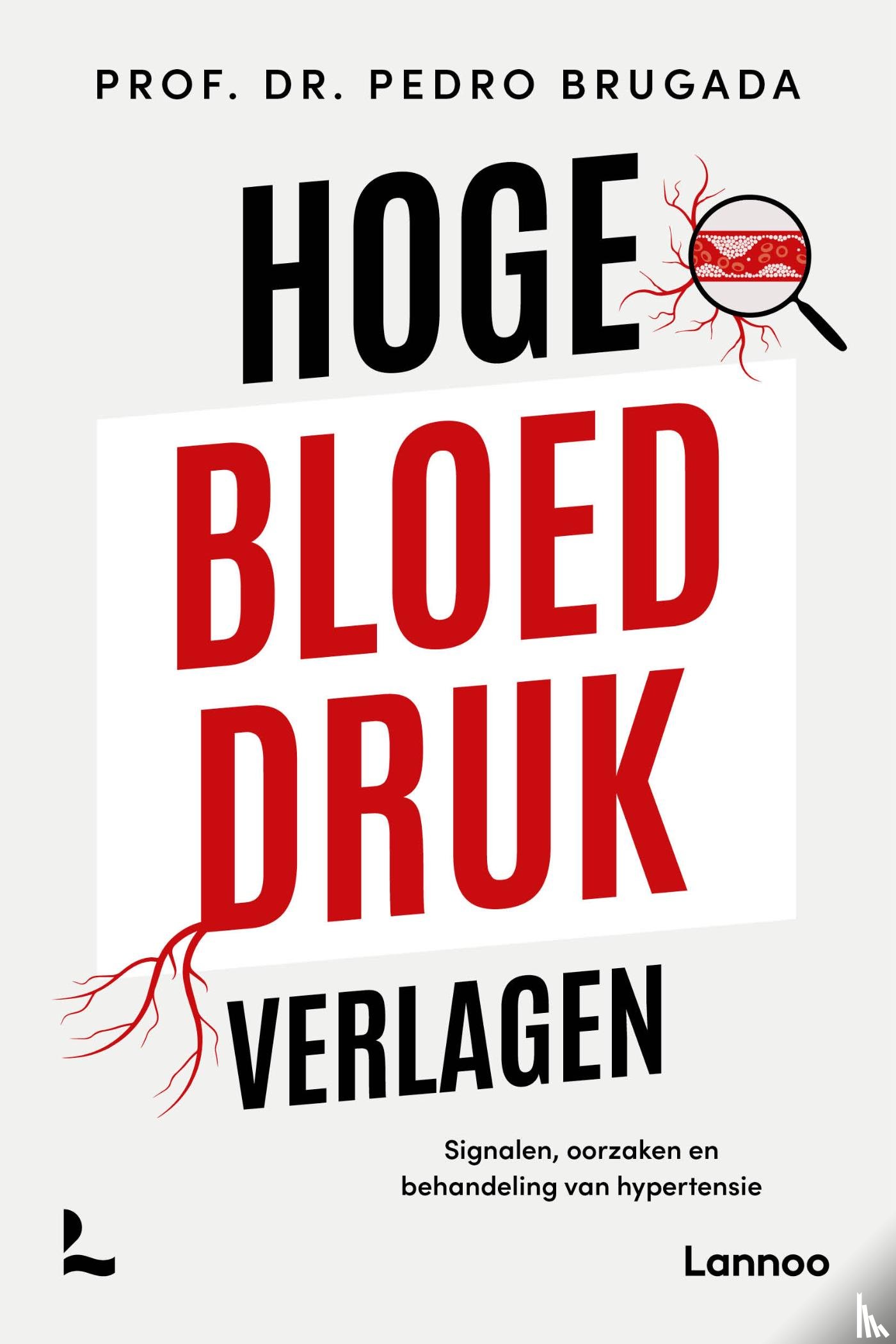 Brugada, Pedro - Hoge bloeddruk verlagen