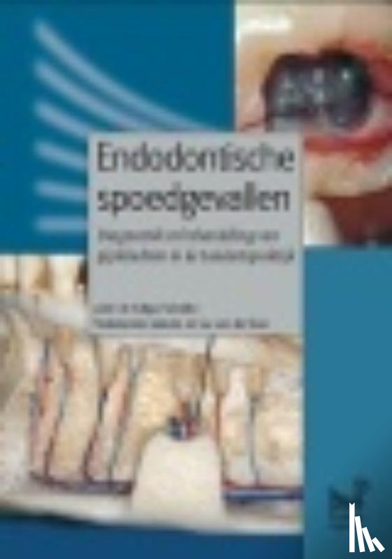 Schäfer, Edgar, Sluis, Luc van der - Endodontische spoedgevallen