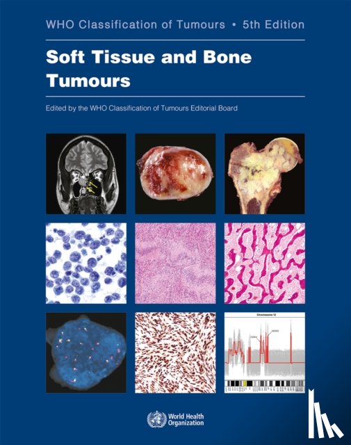 International Agency for Research on Cancer, World Health Organization, International Academy of Pathology - WHO classification of tumours of soft tissue and bone tumours
