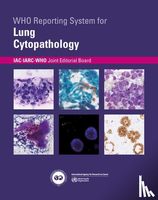  - Who Reporting System for Lung Cytopathology