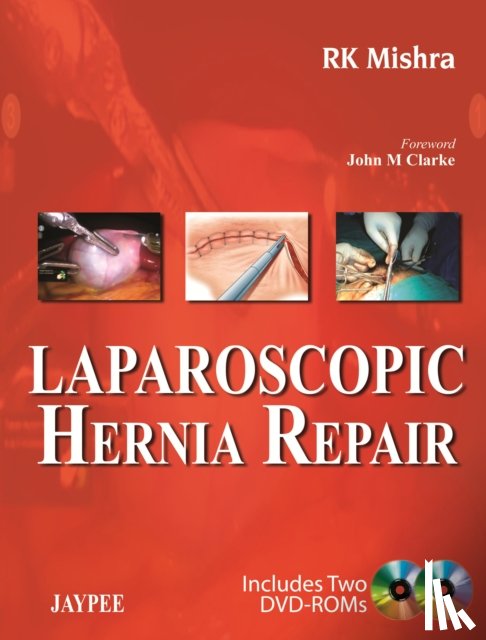 Mishra, RK - Laparoscopic Hernia Repair