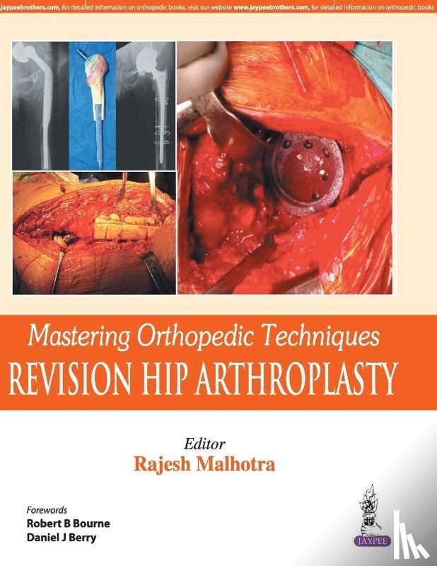 Malhotra, Rajesh - Mastering Orthopedic Techniques: Revision Total Hip Arthroplasty