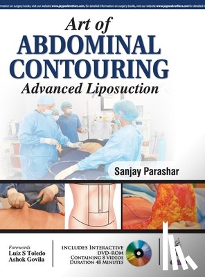 Parashar, Sanjay - Art of Abdominal Contouring