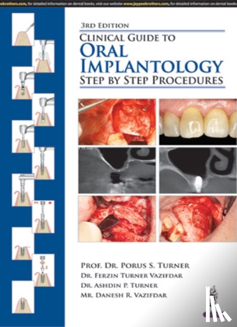 Turner, Porus S, Vazifdar, Ferzin Turner, Turner, Ashdin P, Vazifdar, Danesh R - Clinical Guide to Oral Implantology