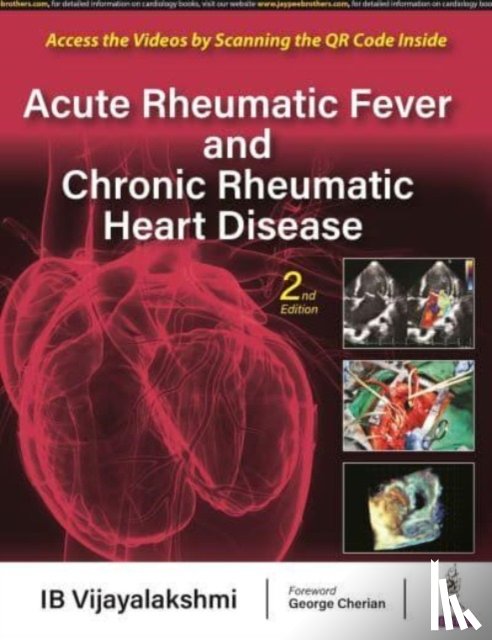 Vijayalakshmi, IB - Acute Rheumatic Fever and Chronic Rheumatic Heart Disease