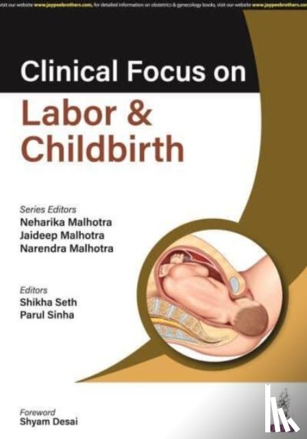 Malhotra, Neharika, Malhotra, Jaideep, Malhotra, Narendra, Seth, Shikha - Clinical Focus on Labor & Childbirth