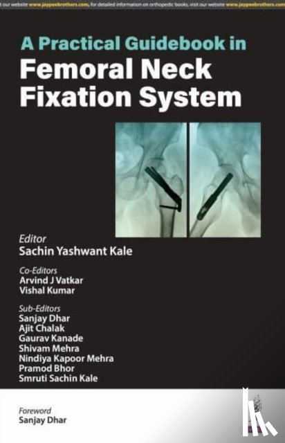Kale, Sachin Yashwant, Vatkar, Arvind J, Kumar, Vishal - A Practical Guidebook in Femoral Neck Fixation System