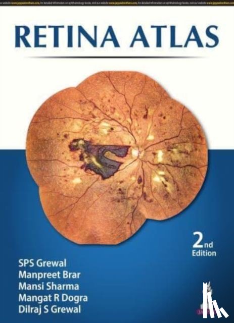 Grewal, SPS, Brar, Manpreet, Sharma, Mansi, Dogra, R Mangat - Retina Atlas