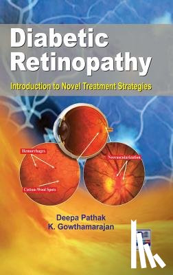 Pathak, Deepa, Gowthamarajan, K - Diabetic Retinopathy